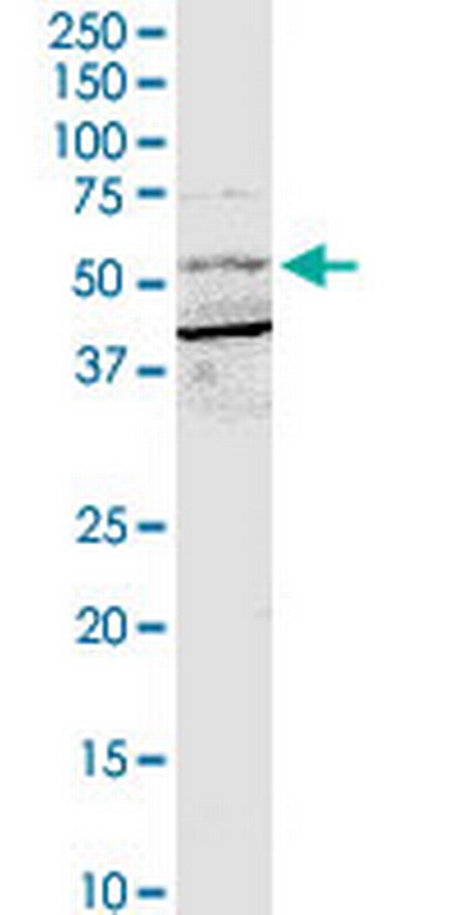 BTRC Antibody in Western Blot (WB)