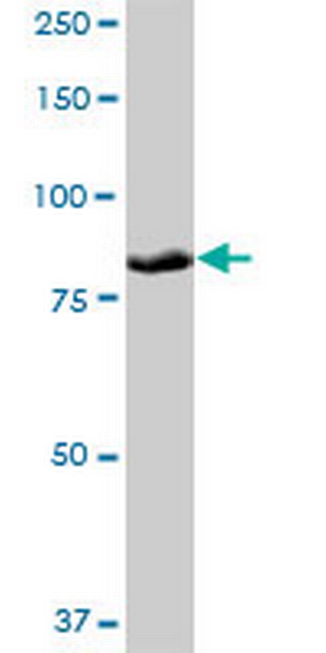 PLOD3 Antibody in Western Blot (WB)