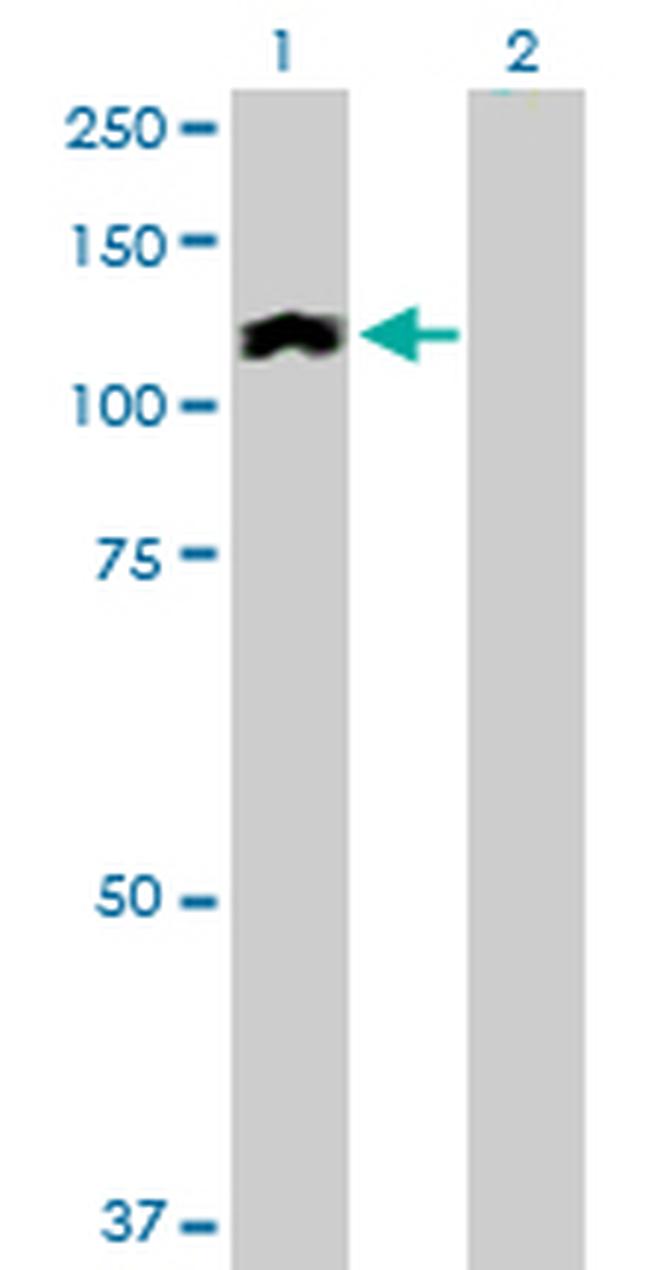 HIP1R Antibody in Western Blot (WB)