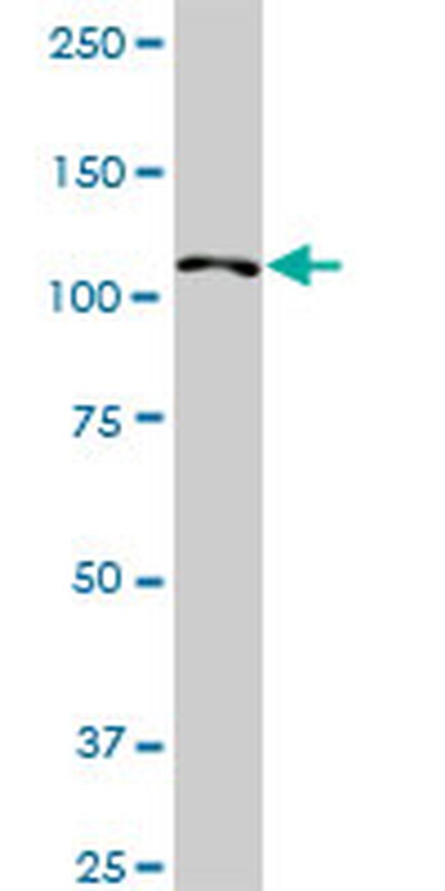 HIP1R Antibody in Western Blot (WB)