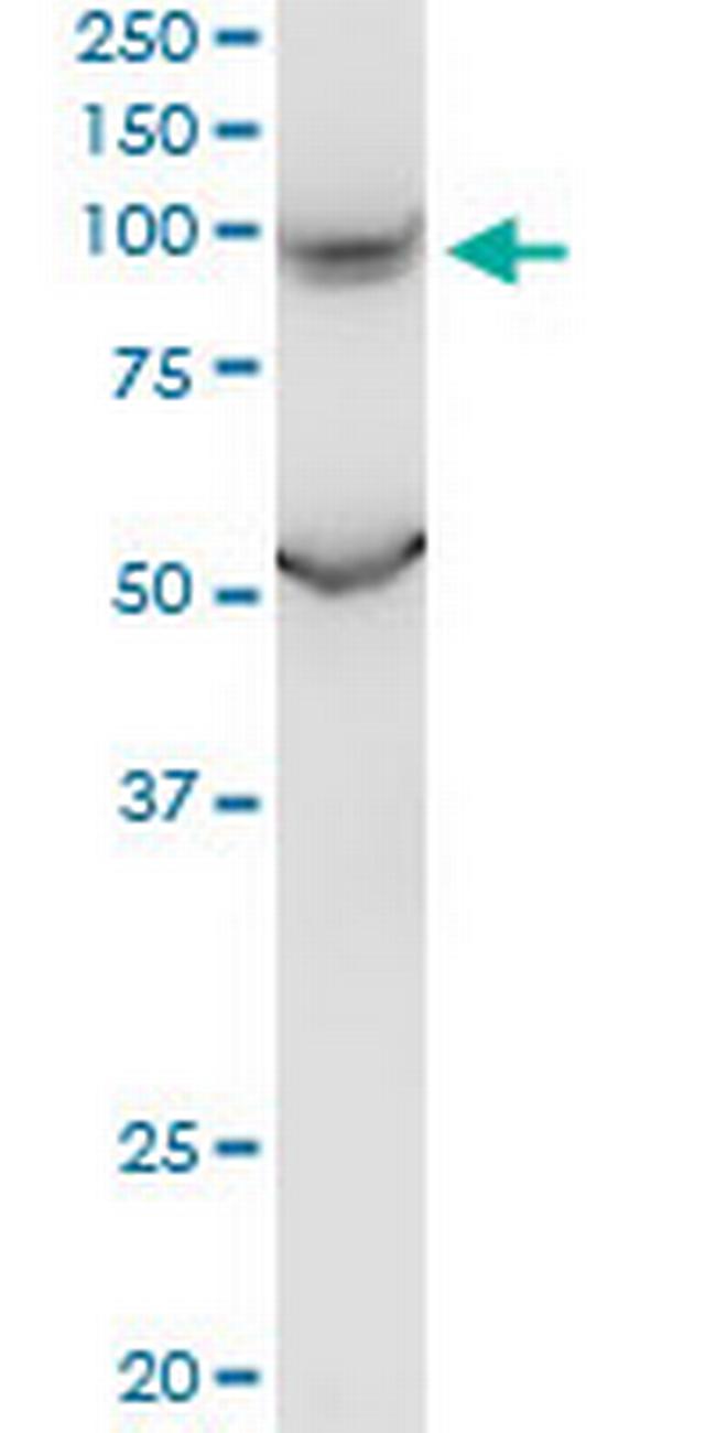 PKD2L1 Antibody in Western Blot (WB)