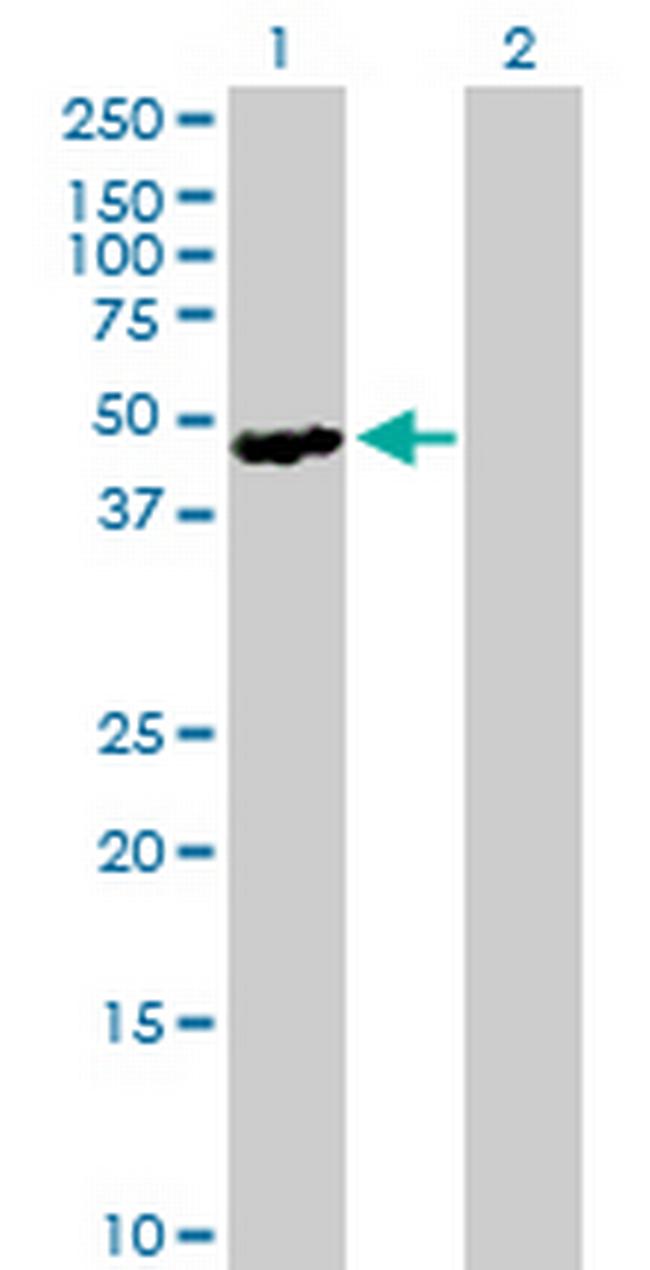 SH2D2A Antibody in Western Blot (WB)