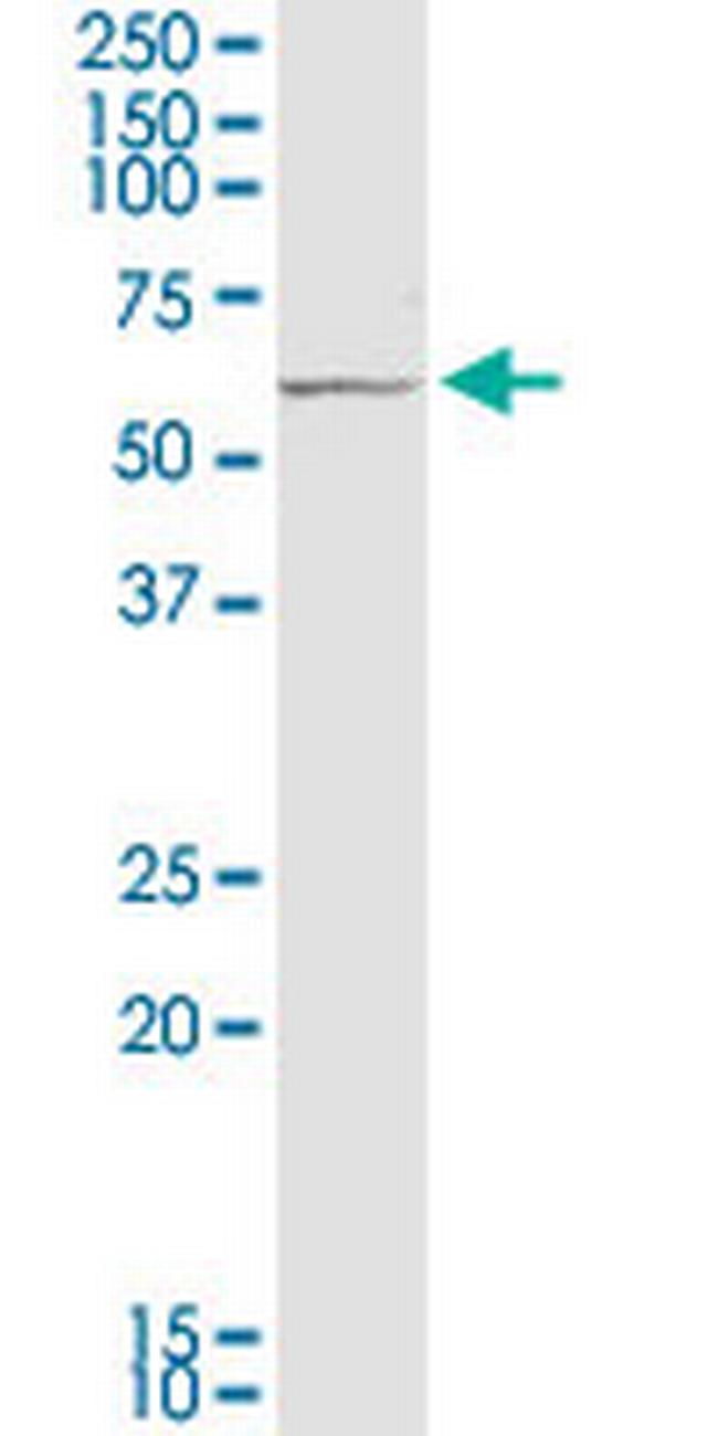 PRC1 Antibody in Western Blot (WB)