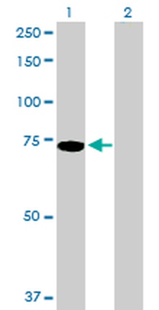 PIAS2 Antibody in Western Blot (WB)