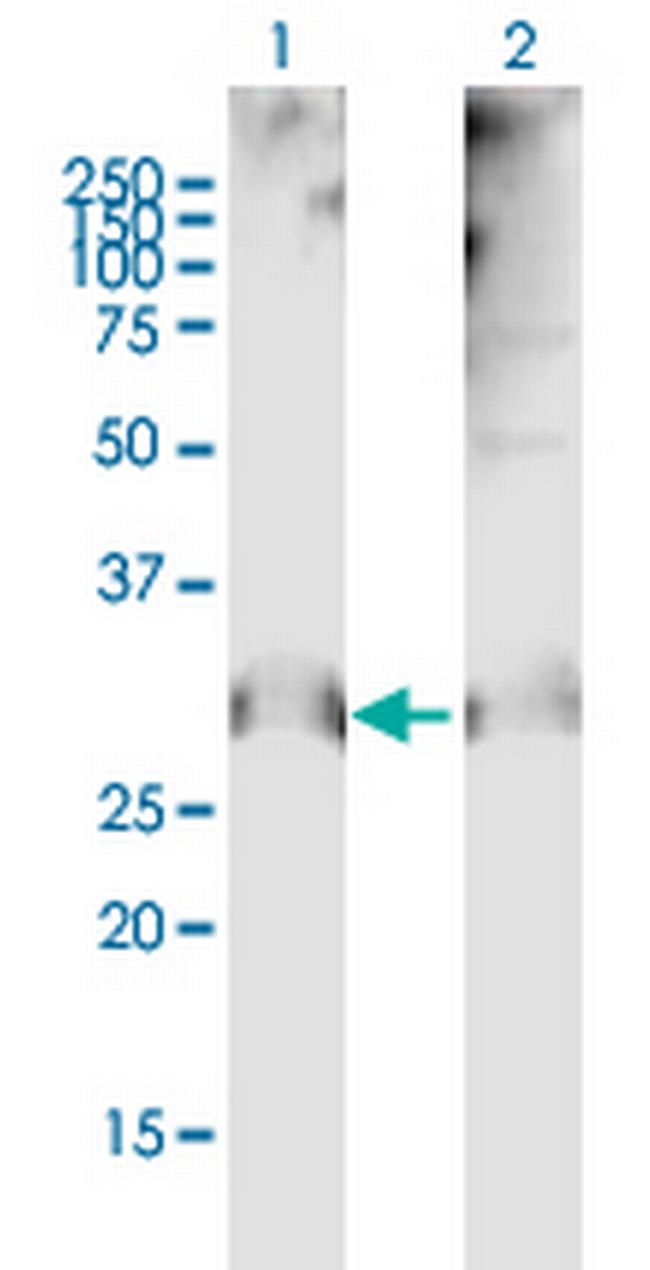 CLDN12 Antibody in Western Blot (WB)