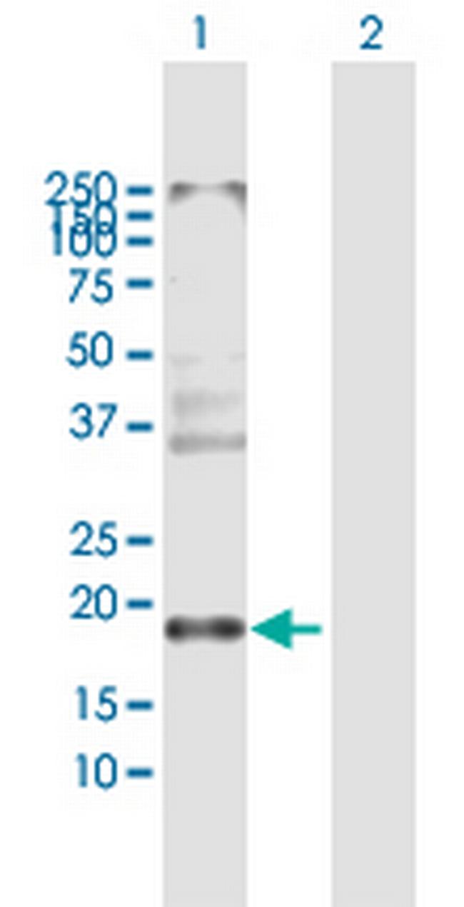 CLDN8 Antibody in Western Blot (WB)