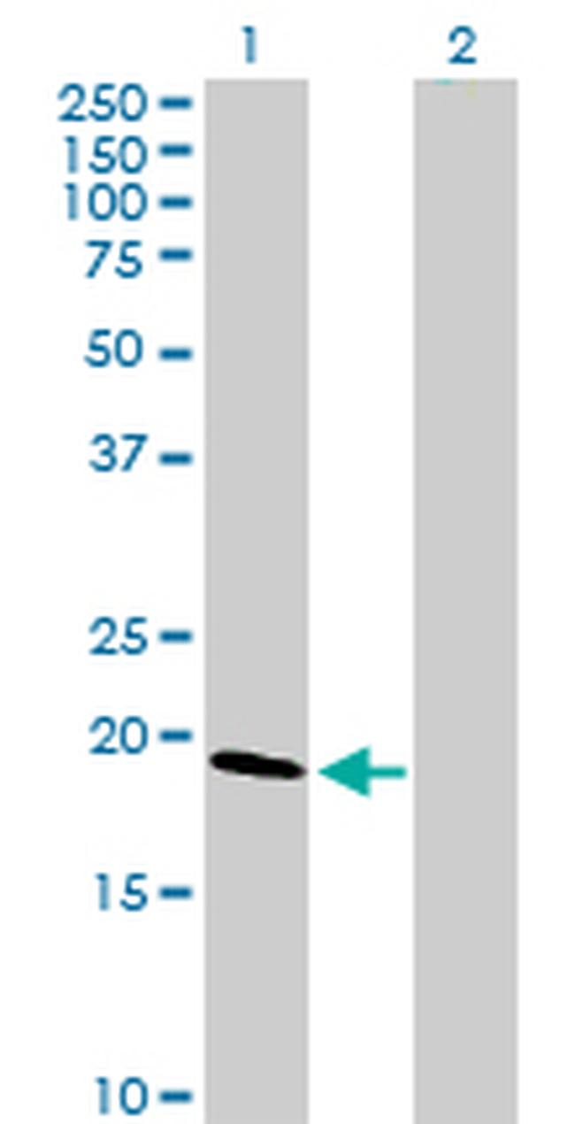 CLDN1 Antibody in Western Blot (WB)