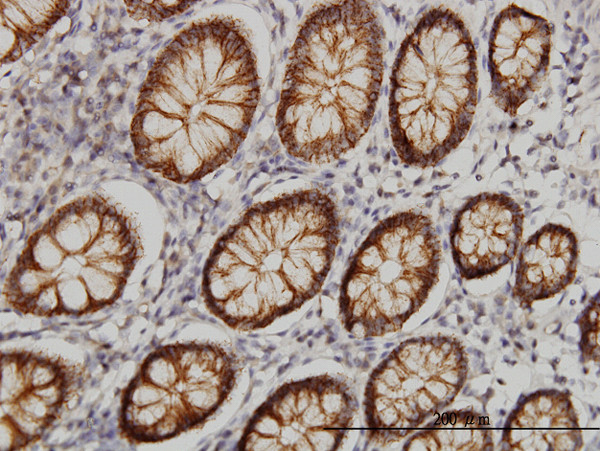 CLDN1 Antibody in Immunohistochemistry (Paraffin) (IHC (P))