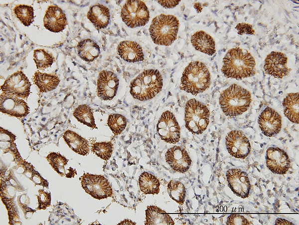 CLDN1 Antibody in Immunohistochemistry (Paraffin) (IHC (P))