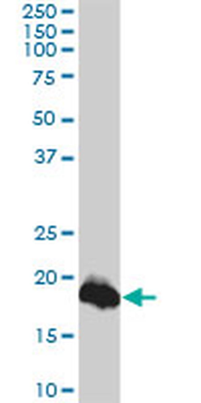 CLDN1 Antibody in Western Blot (WB)