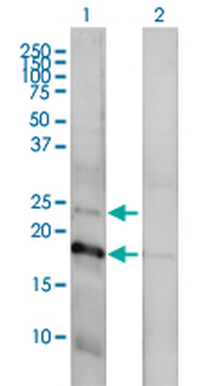 CLDN1 Antibody in Western Blot (WB)