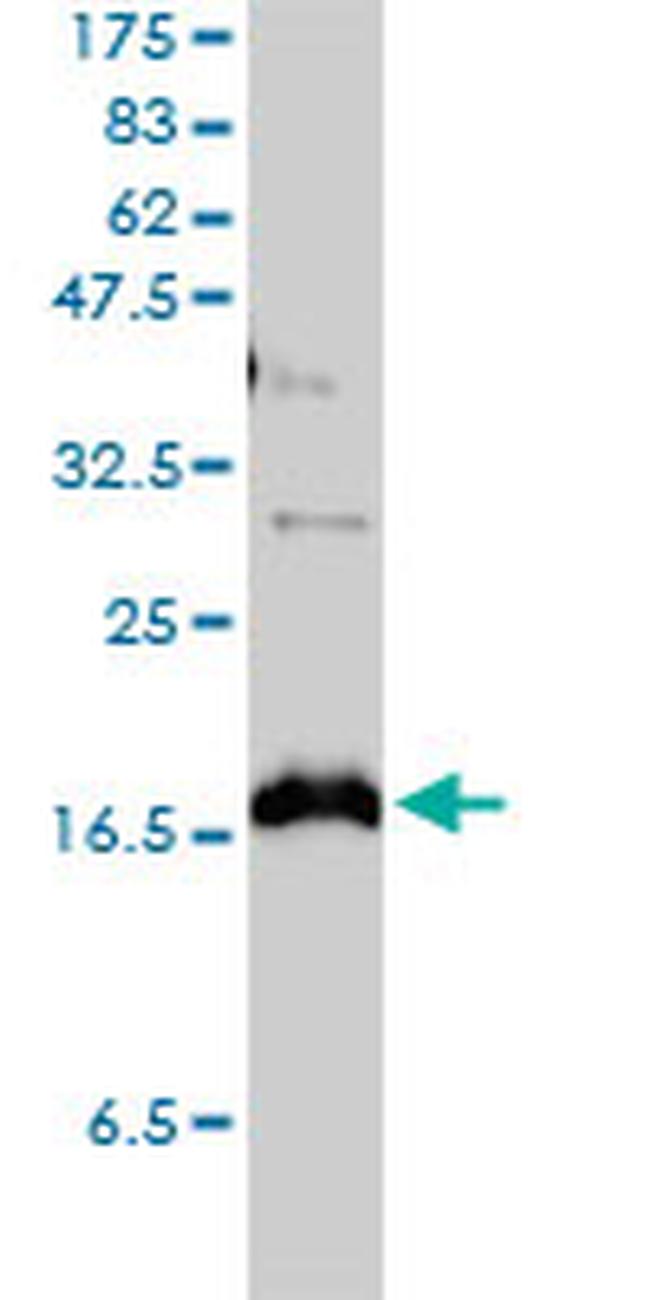 CLDN1 Antibody in Western Blot (WB)