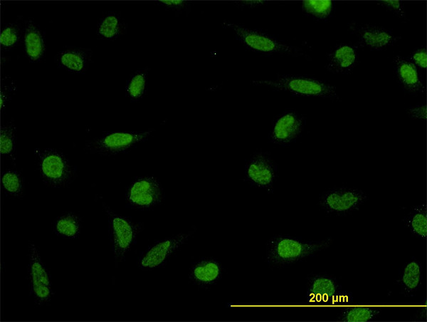 LDB2 Antibody in Immunocytochemistry (ICC/IF)