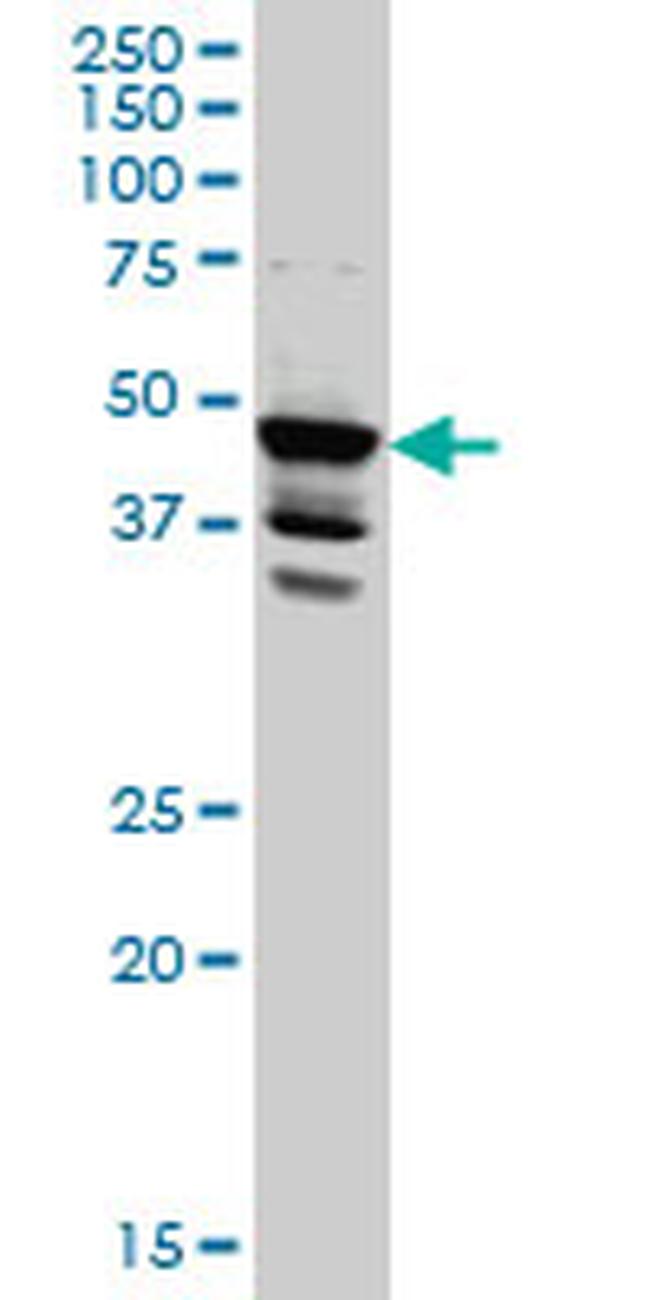 LDB2 Antibody in Western Blot (WB)