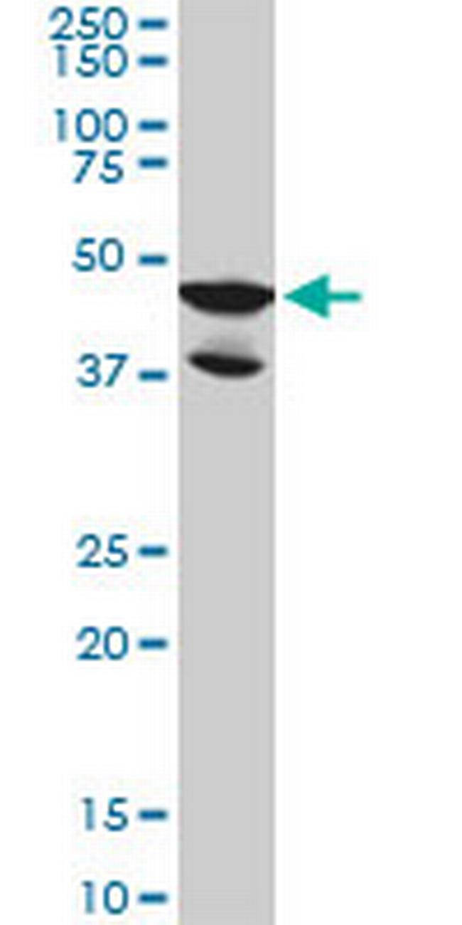 LDB2 Antibody in Western Blot (WB)