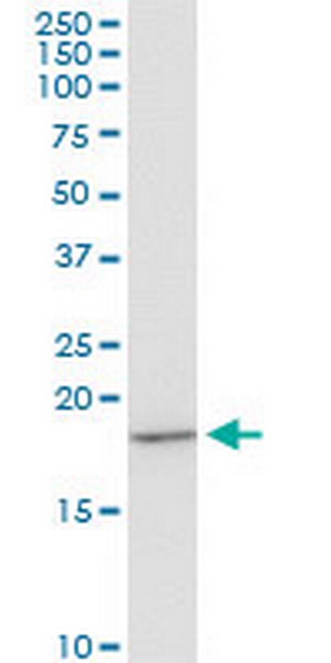 EIF1AY Antibody in Western Blot (WB)