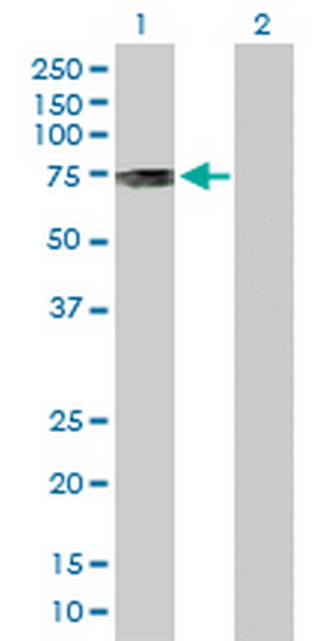 PKMYT1 Antibody in Western Blot (WB)