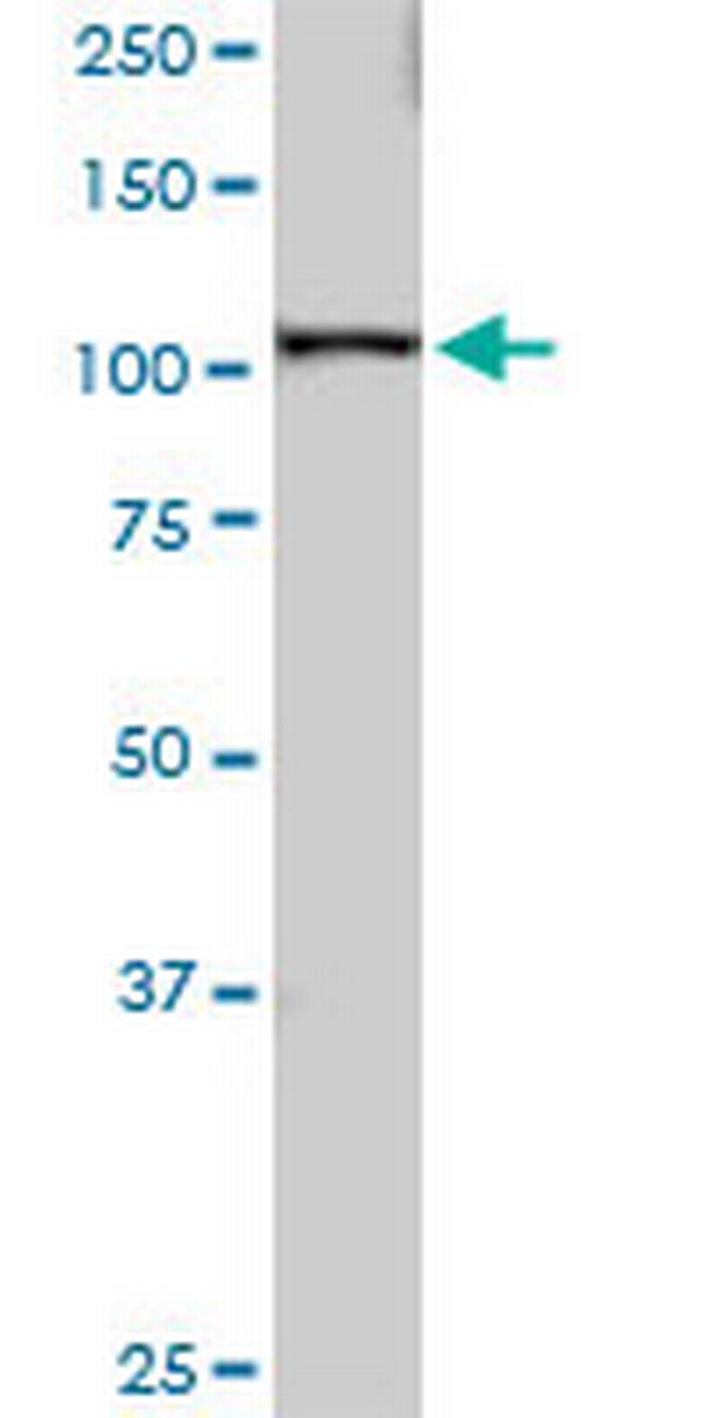 SART1 Antibody in Western Blot (WB)