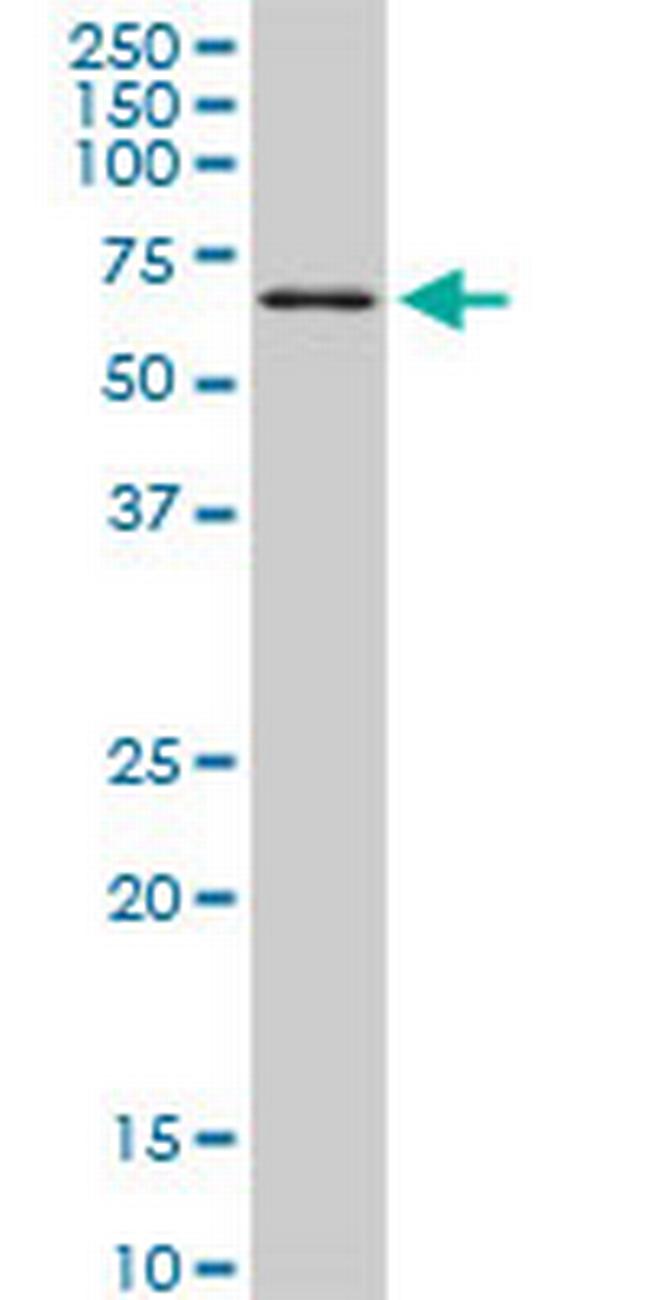 TBX18 Antibody in Western Blot (WB)