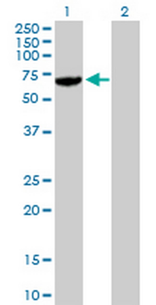 USP14 Antibody in Western Blot (WB)