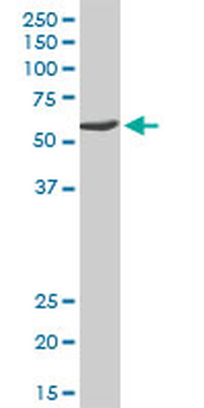 USP14 Antibody in Western Blot (WB)