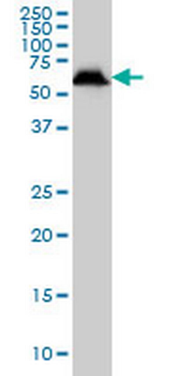 USP14 Antibody in Western Blot (WB)