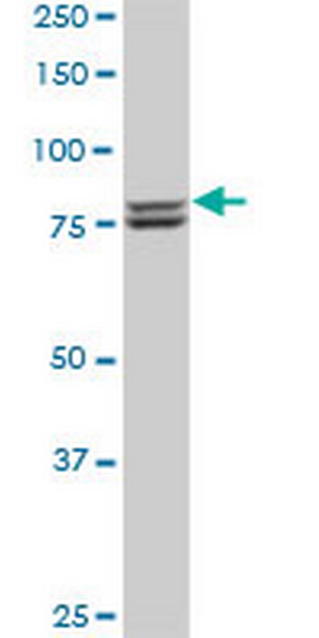 MTA1 Antibody in Western Blot (WB)