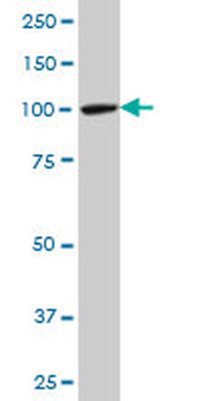 MTA1 Antibody in Western Blot (WB)