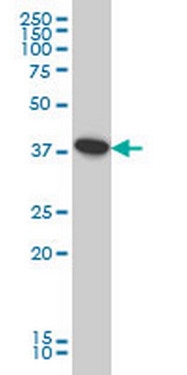 ATP6V0D1 Antibody in Western Blot (WB)