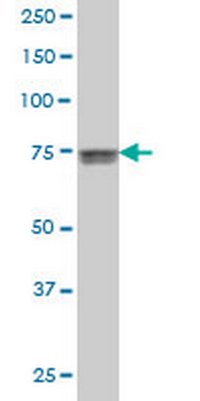 KCNQ4 Antibody in Western Blot (WB)