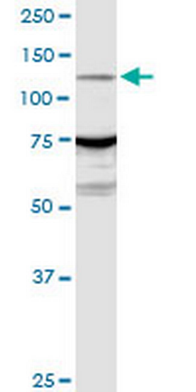 ARHGEF1 Antibody in Western Blot (WB)