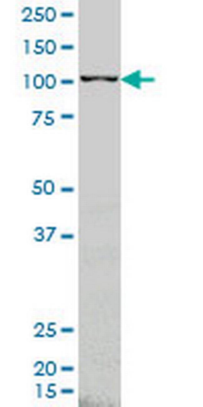 ARHGEF1 Antibody in Western Blot (WB)