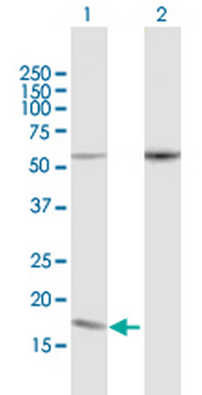 PDCD5 Antibody in Western Blot (WB)