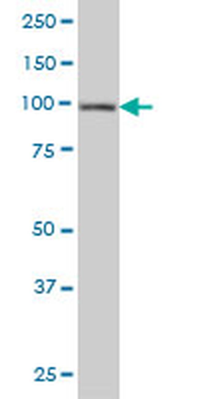 HGS Antibody in Western Blot (WB)