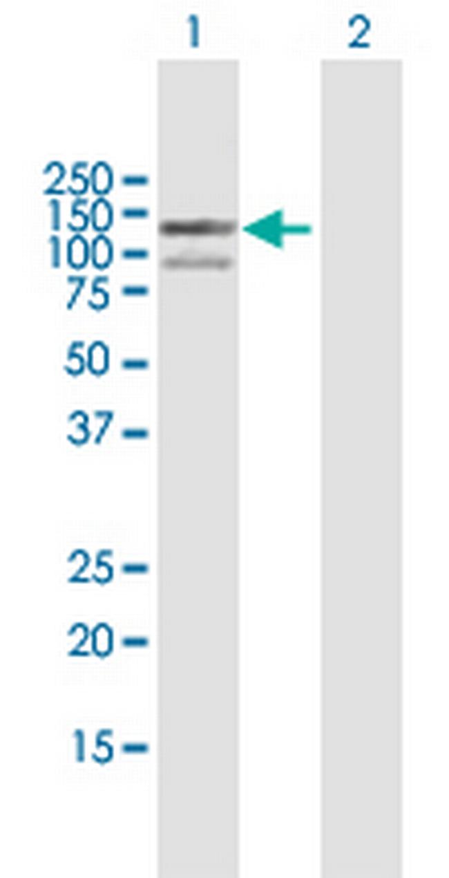 EXO1 Antibody in Western Blot (WB)