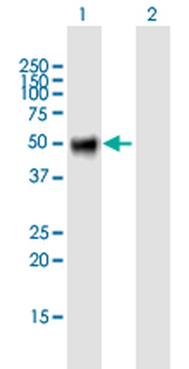 OSMR Antibody in Western Blot (WB)