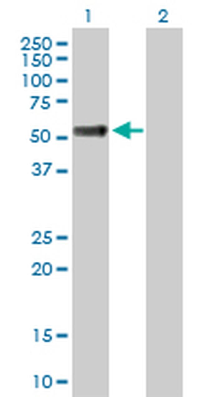 OSMR Antibody in Western Blot (WB)