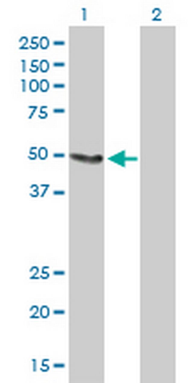 SLC33A1 Antibody in Western Blot (WB)