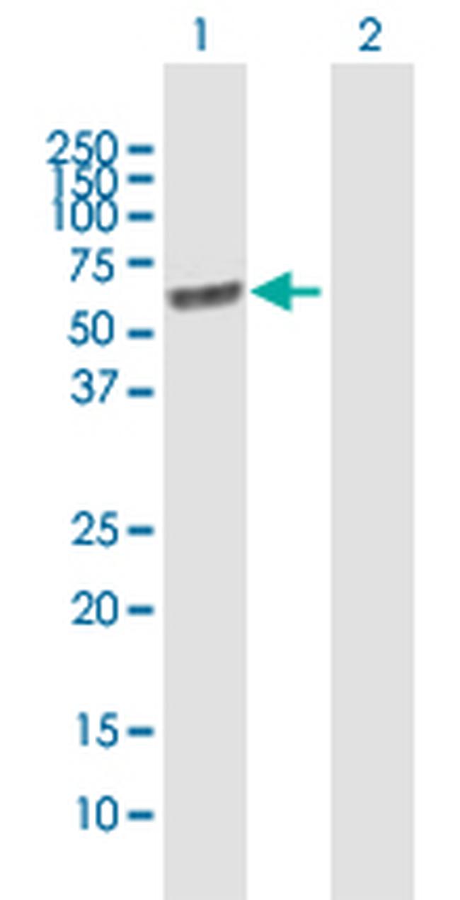 LGI1 Antibody in Western Blot (WB)