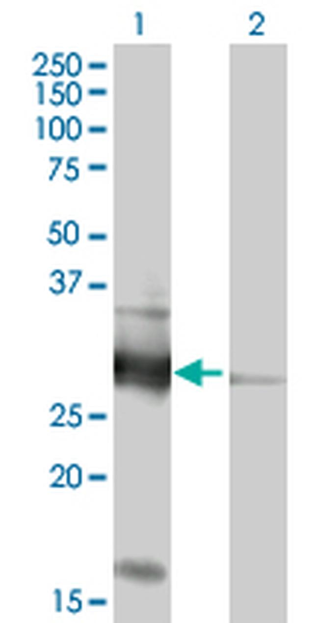 VAPB Antibody in Western Blot (WB)