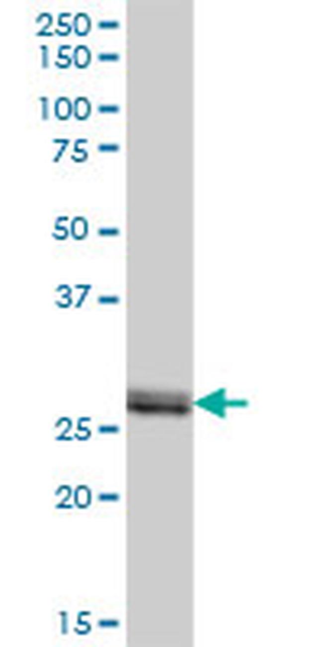 VAPB Antibody in Western Blot (WB)