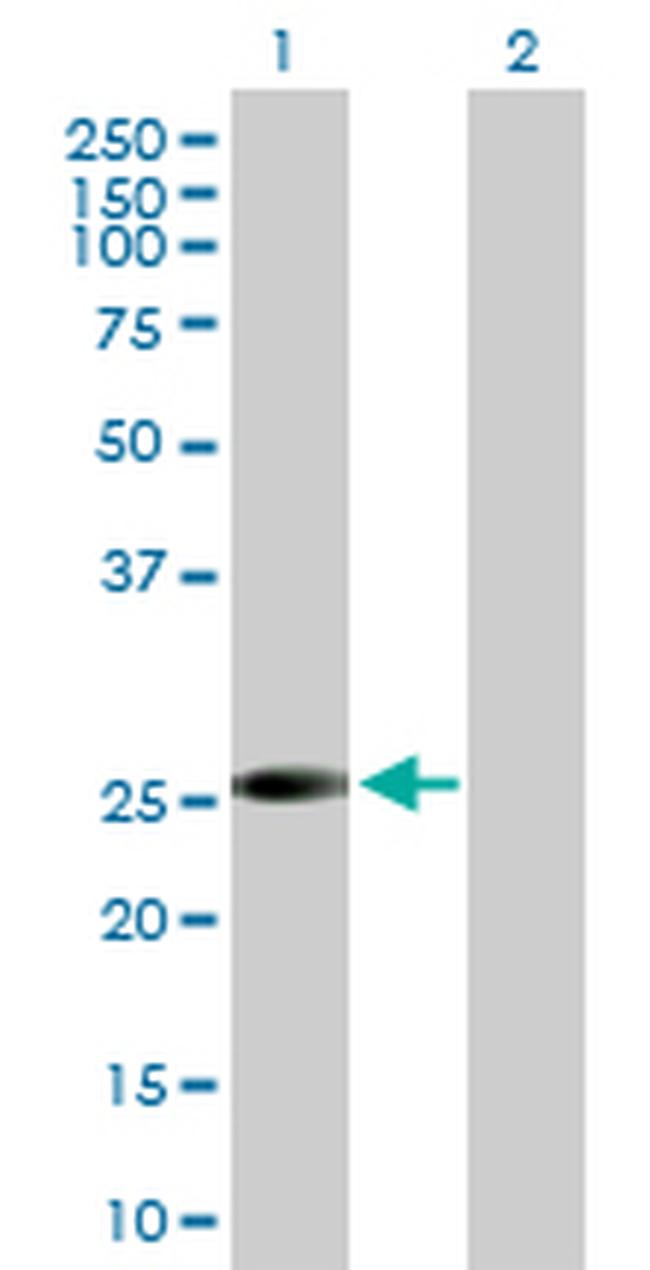 VAPB Antibody in Western Blot (WB)