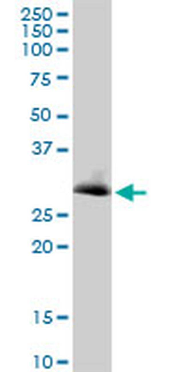 VAPB Antibody in Western Blot (WB)