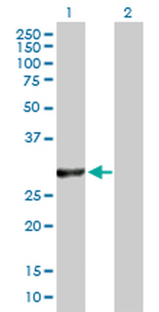 VAPB Antibody in Western Blot (WB)