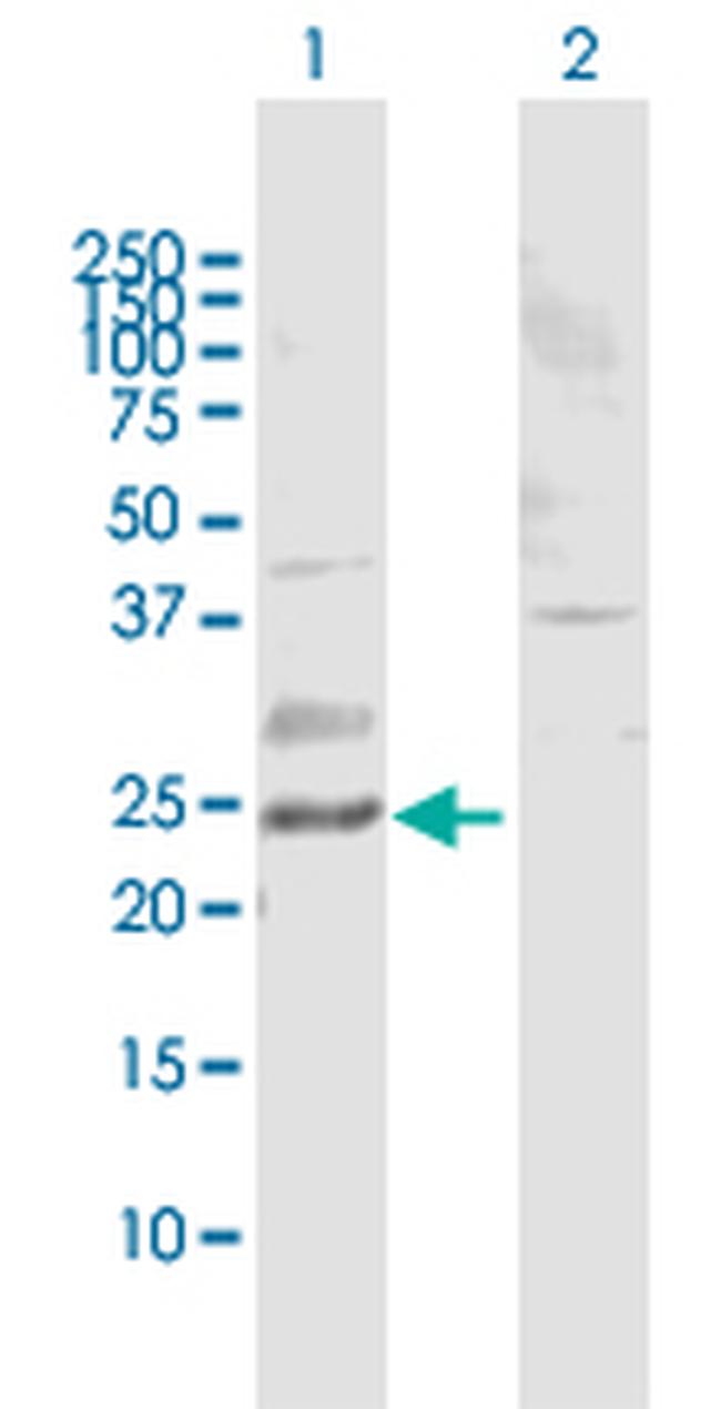 RAB11B Antibody in Western Blot (WB)