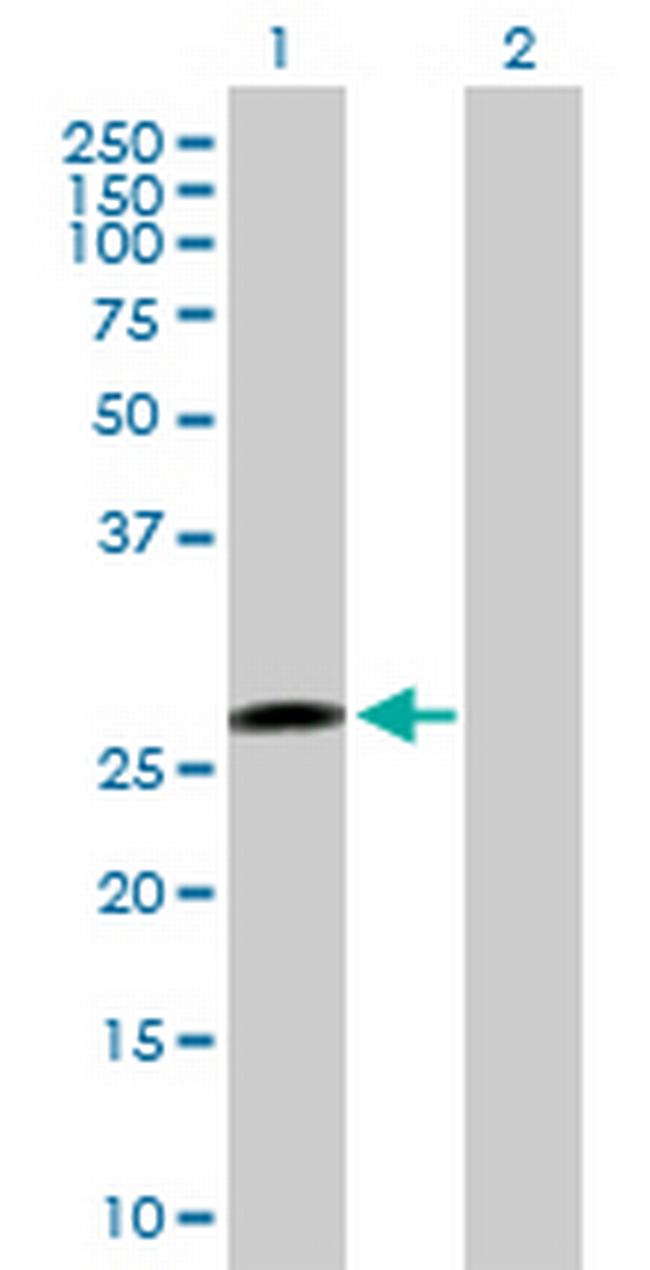 PTTG1 Antibody in Western Blot (WB)