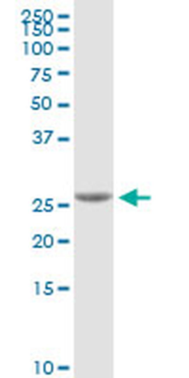 NOG Antibody in Western Blot (WB)