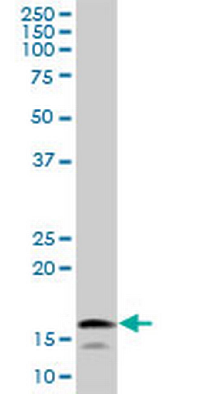 UBE2L6 Antibody in Western Blot (WB)