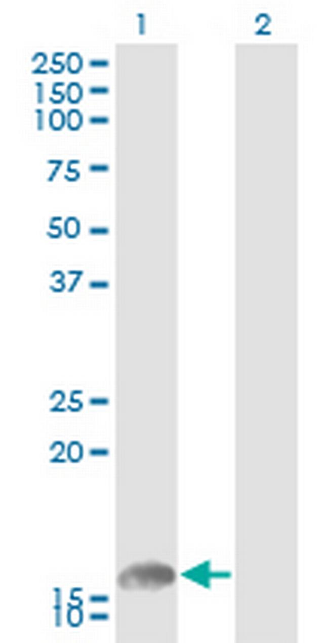 UBE2L6 Antibody in Western Blot (WB)