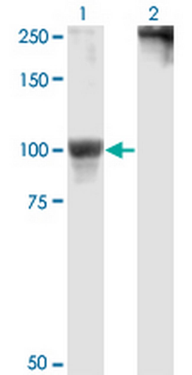 RPS6KA5 Antibody in Western Blot (WB)